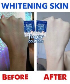 Frozen collagen 2 in 1 review in pakistan